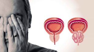 Zdravá a zanícená prostata