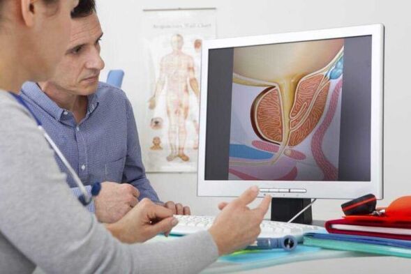 lékař konzultuje pacienta v otázce prostatitidy